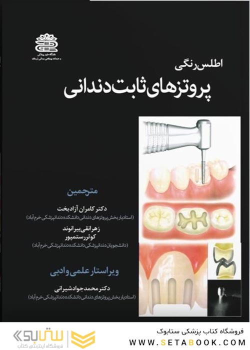 اطلس پروتزهای ثابت دندانی جلد 1