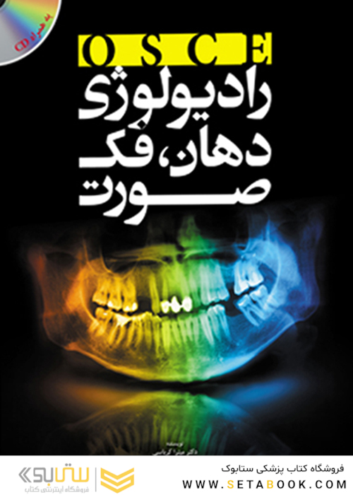 osceرادیولوژی دهان ، فک وصورت