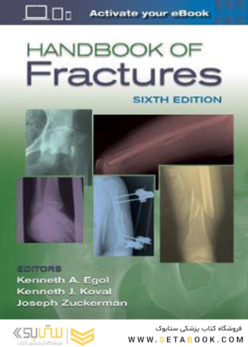 Handbook of Fractures Sixth Edition