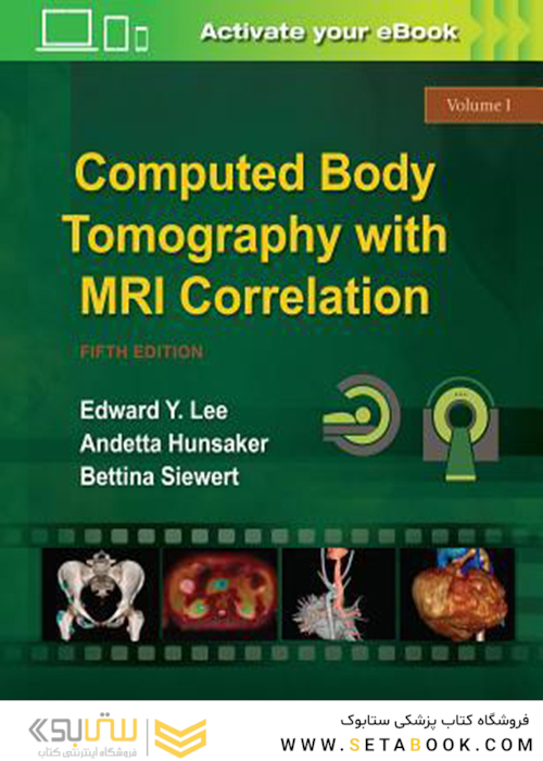 Computed Body Tomography with MRI Correlation