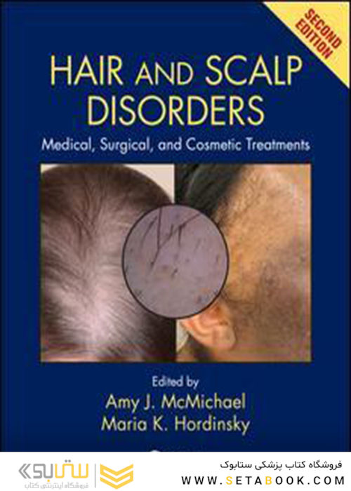 Hair and Scalp Disorders: Medical, Surgical, and Cosmetic Treatments, Second Edition2018