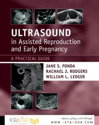 Ultrasound in Assisted Reproduction and Early Pregnancy: A Practical Guide 1st Edición