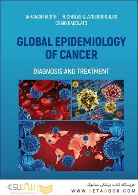 Global Epidemiology of Cancer: Diagnosis and Treatment 1st Edición