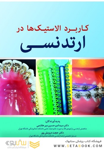 کاربرد الاستیک ها در ارتدنسی