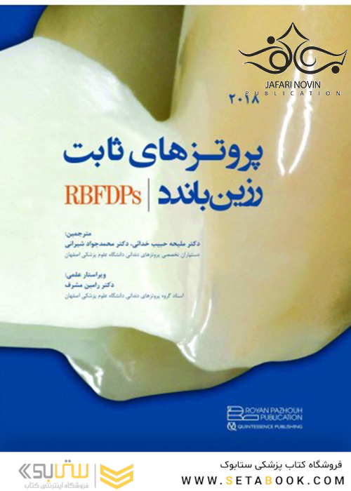 پروتزهای ثابت رزین و باندد 2018