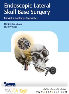 Endoscopic Lateral Skull Base Surgery