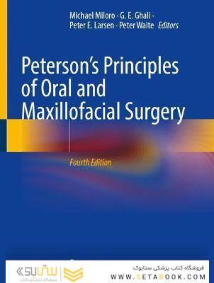 Peterson