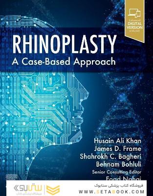 Rhinoplasty : a Case-based approach