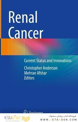 Renal Cancer: Current Status and Innovations