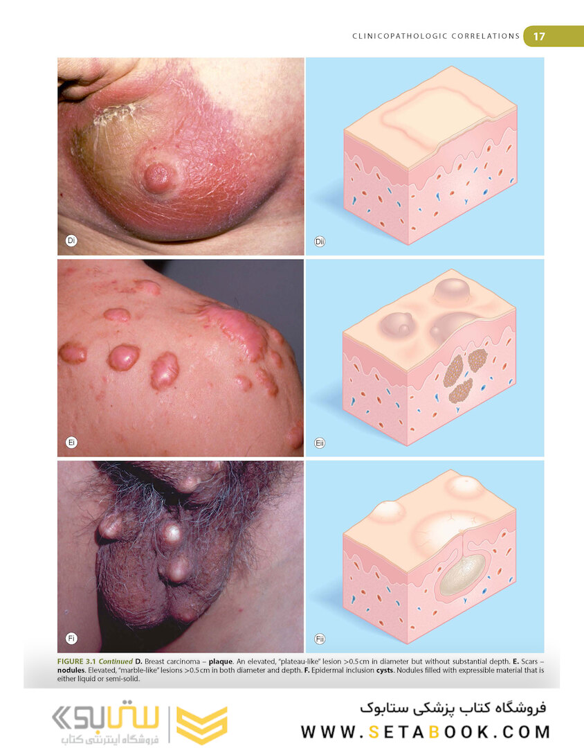 Lookingbill and Marks