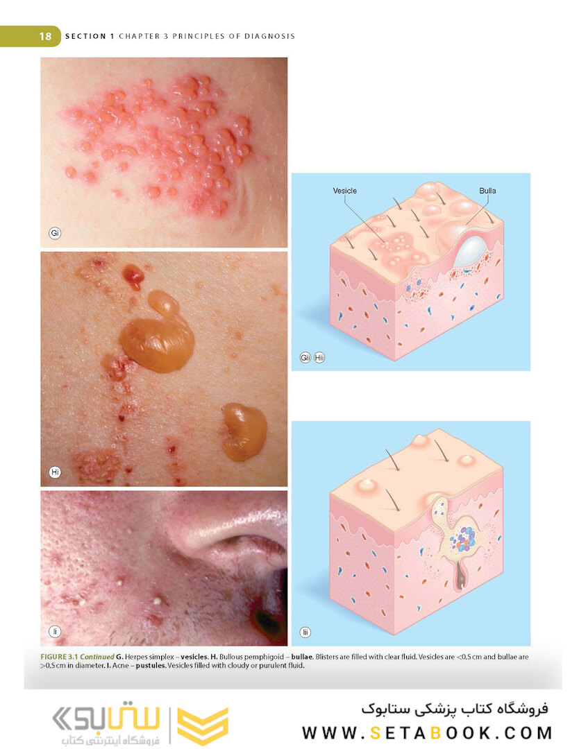 Lookingbill and Marks