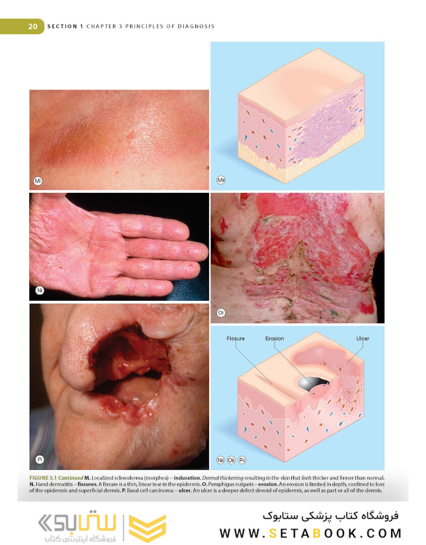 Lookingbill and Marks