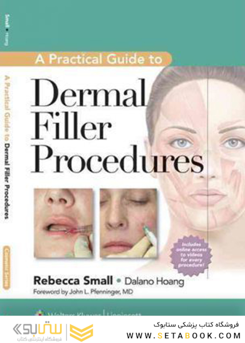 A Practical Guide to Dermal Filler Procedures