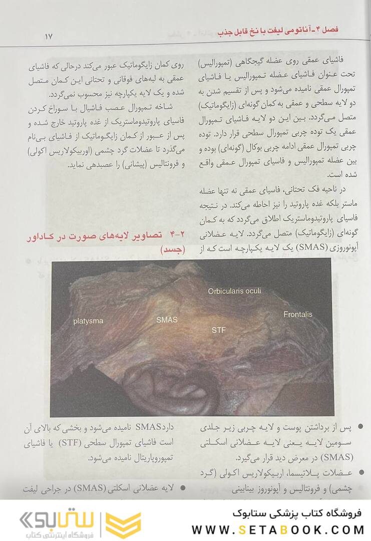 راهنمای کاربردی علم و هنر لیفت با نخ