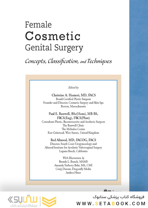 Female Cosmetic Genital Surgery: Concepts, classification and techniques 1st Edition 2017