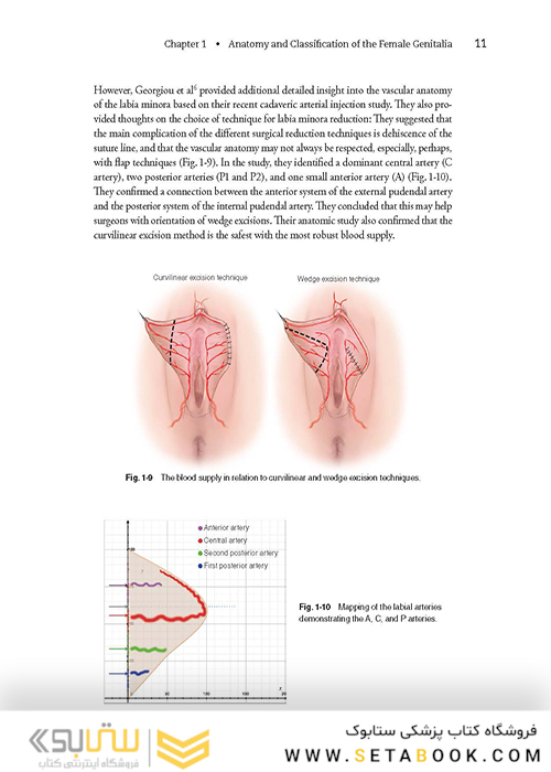 Female Cosmetic Genital Surgery: Concepts, classification and techniques 1st Edition 2017