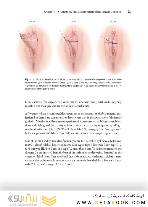Female Cosmetic Genital Surgery: Concepts, classification and techniques 1st Edition 2017