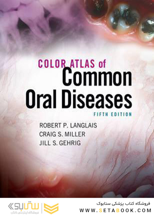 Color Atlas of Common Oral Diseases