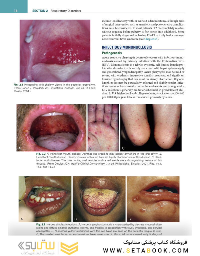 Nelson Pediatric Symptom-Based Diagnosis 2nd Edicion 2023
