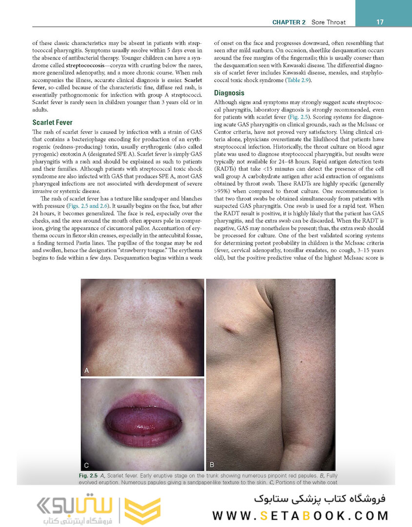 Nelson Pediatric Symptom-Based Diagnosis 2nd Edicion 2023