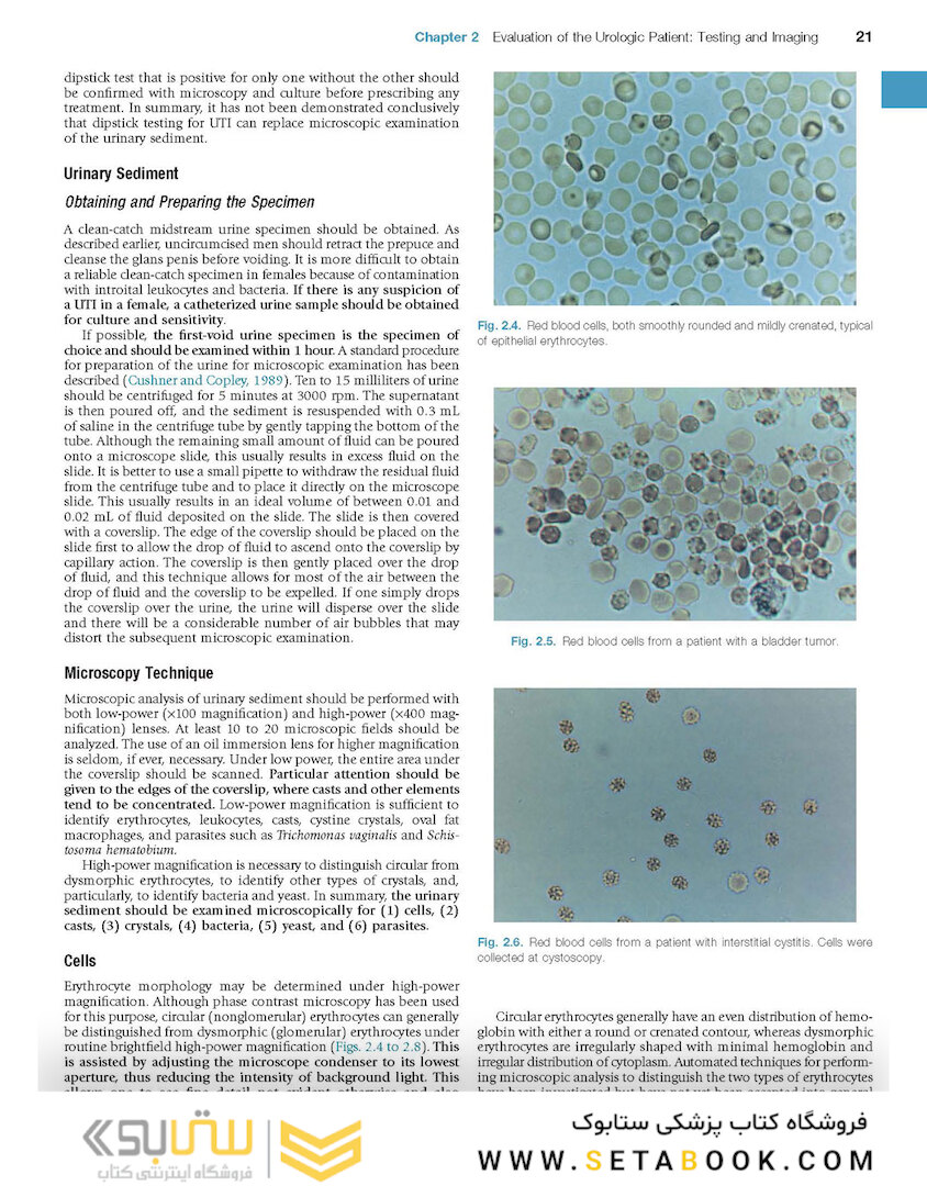 Campbell-Walsh Urology: 4-Volume Set 12th Edition