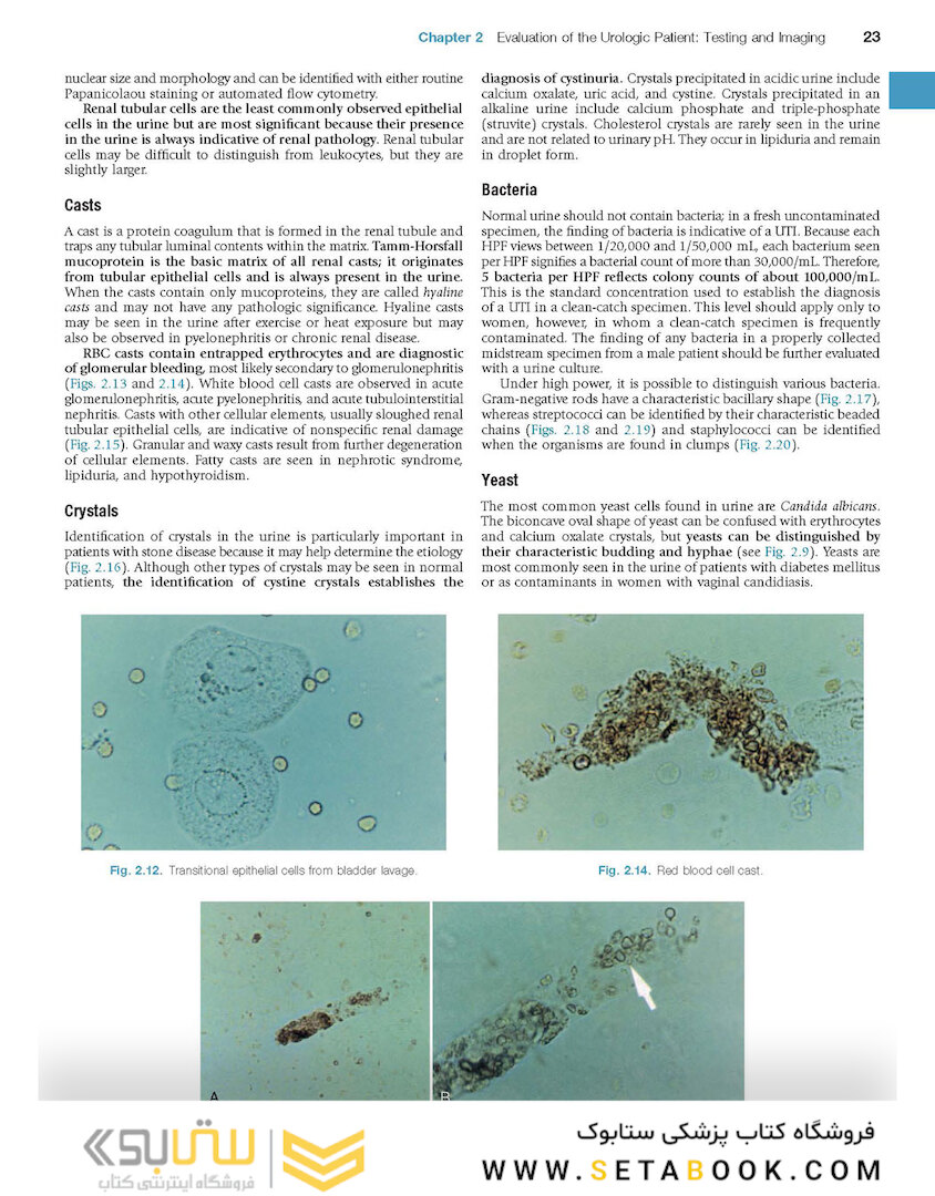 Campbell-Walsh Urology: 4-Volume Set 12th Edition