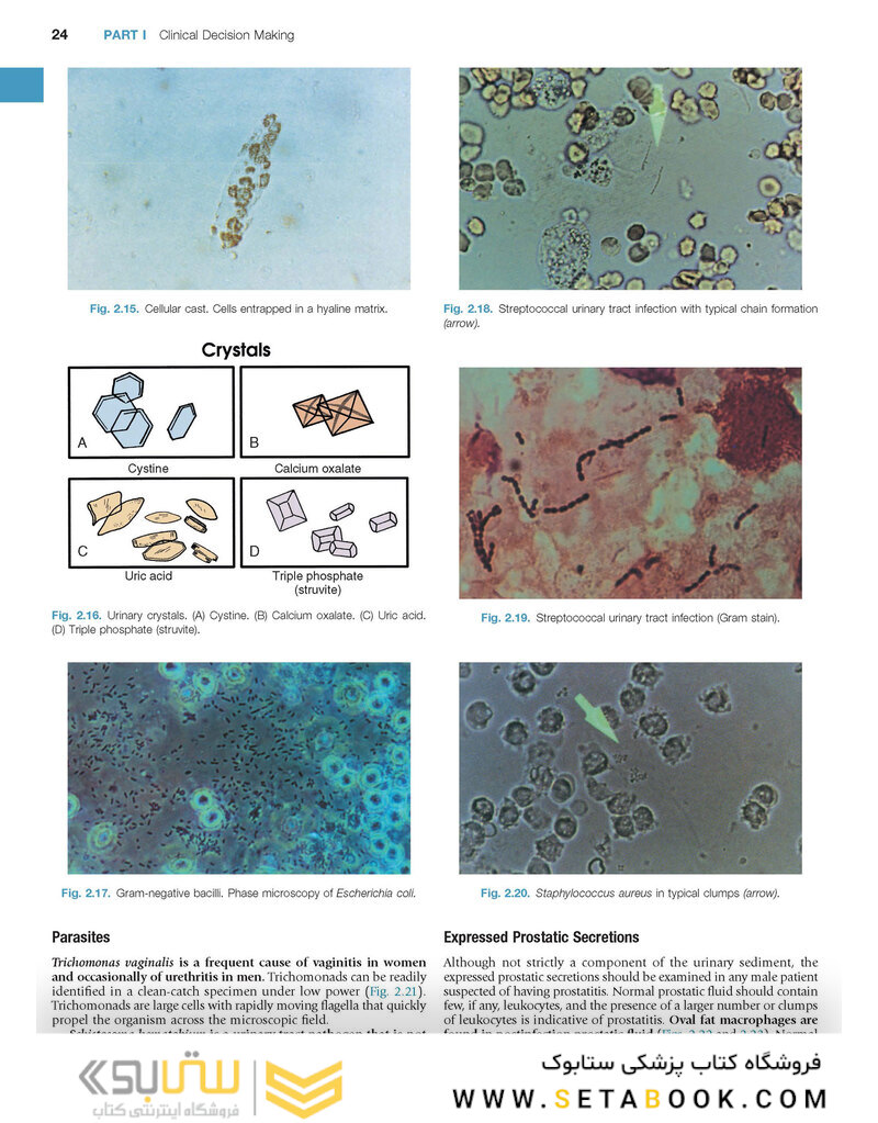 Campbell-Walsh Urology: 4-Volume Set 12th Edition
