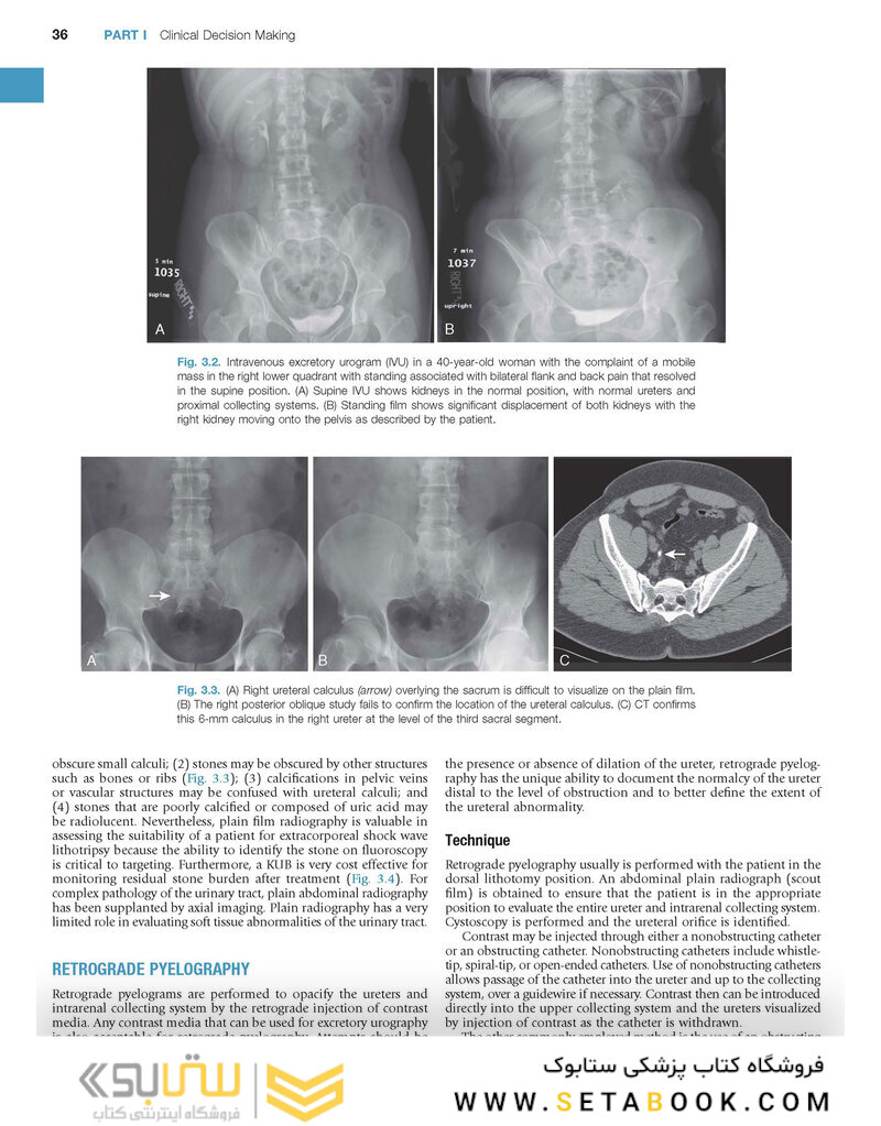 Campbell-Walsh Urology: 4-Volume Set 12th Edition