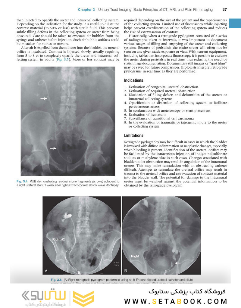 Campbell-Walsh Urology: 4-Volume Set 12th Edition