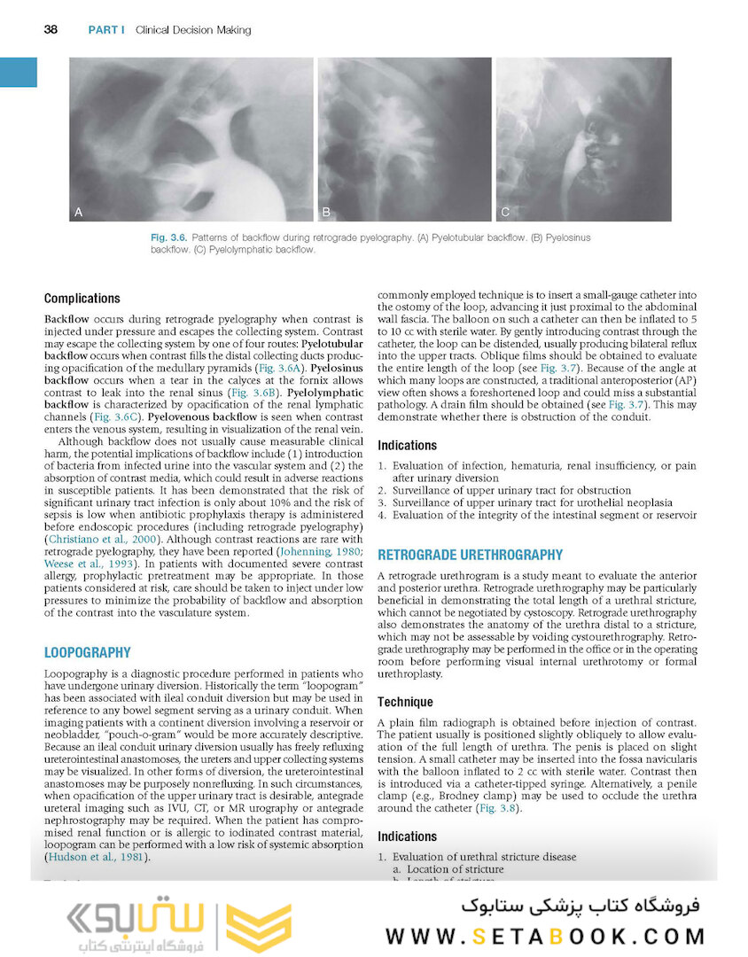 Campbell-Walsh Urology: 4-Volume Set 12th Edition