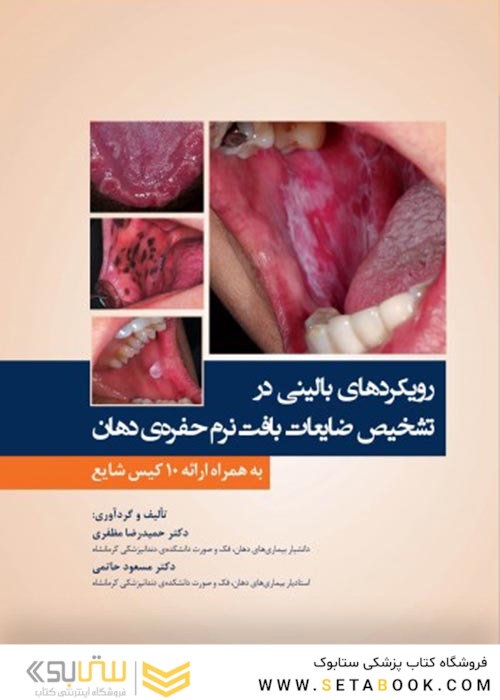 رویکردهای بالینی در تشخیص ضایعات بافت نرم حفره ی دهان به همراه ارائه 10 کیس شایع