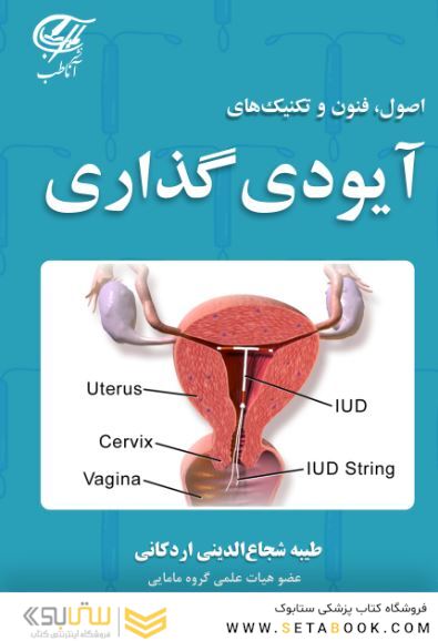 اصول فنون و تکنیک های آیودی گذاری