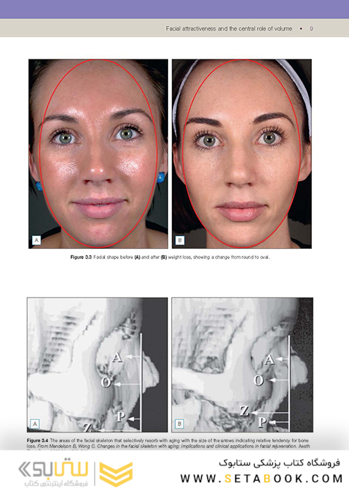 Soft Tissue Augmentation: Procedures in Cosmetic Dermatology Series