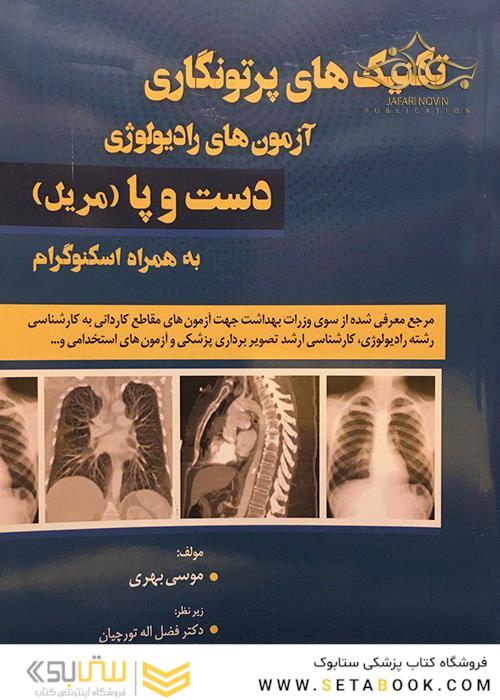 تکنیک های پرتونگاری آزمون های رادیولوژِی دست و پا (مریل) به همراه اسکنوگرام سیاه و سفید