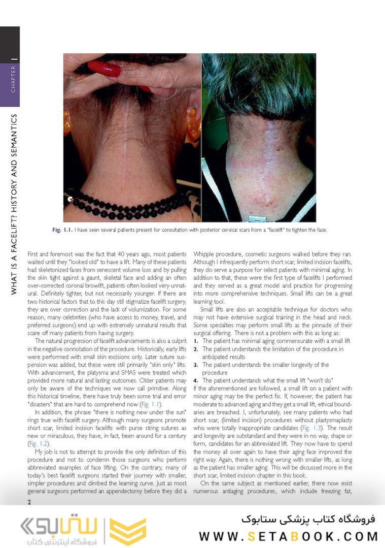 The Art and Science of Facelift Surgery: A Video Atlas 1st Edicion 2019