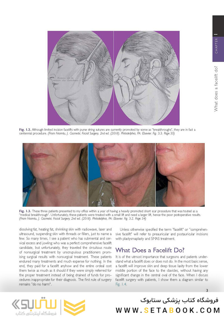 The Art and Science of Facelift Surgery: A Video Atlas 1st Edicion 2019
