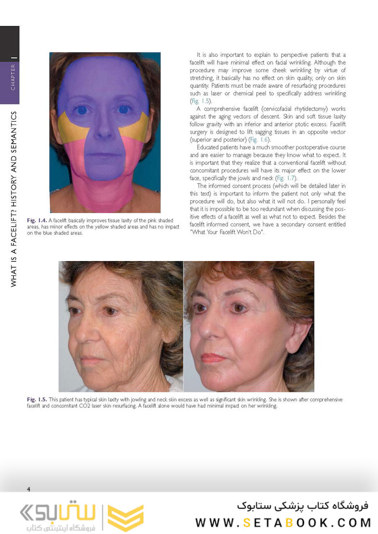 The Art and Science of Facelift Surgery: A Video Atlas 1st Edicion 2019