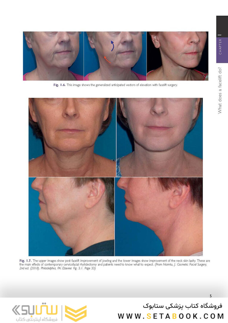The Art and Science of Facelift Surgery: A Video Atlas 1st Edicion 2019