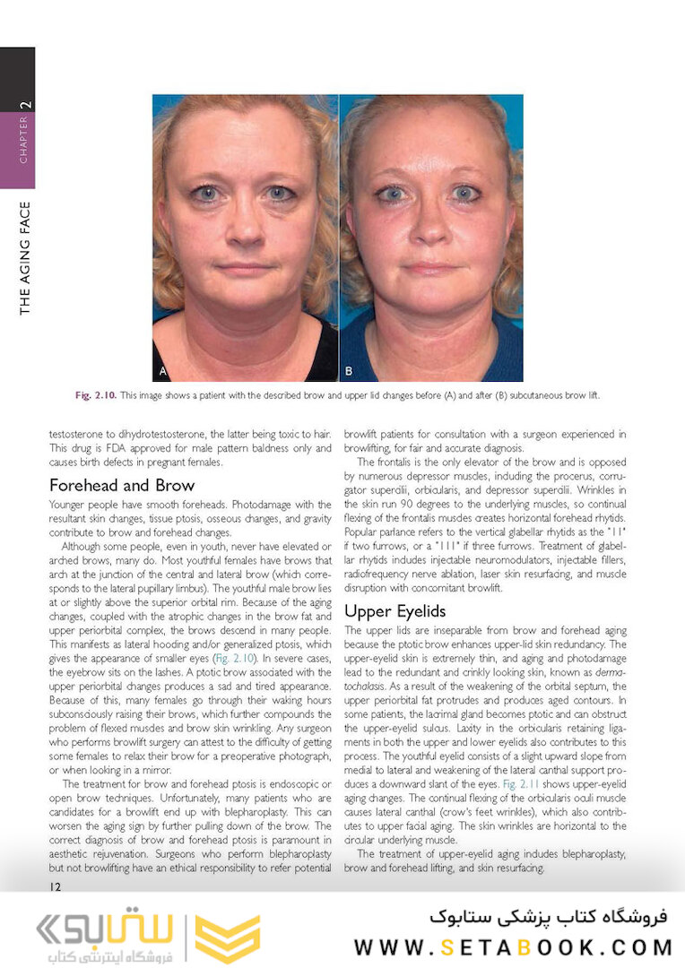 The Art and Science of Facelift Surgery: A Video Atlas 1st Edicion 2019