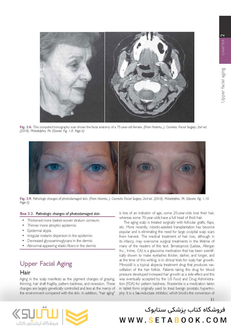 The Art and Science of Facelift Surgery: A Video Atlas 1st Edicion 2019