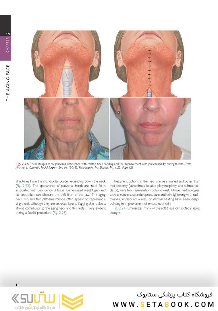 The Art and Science of Facelift Surgery: A Video Atlas 1st Edicion 2019