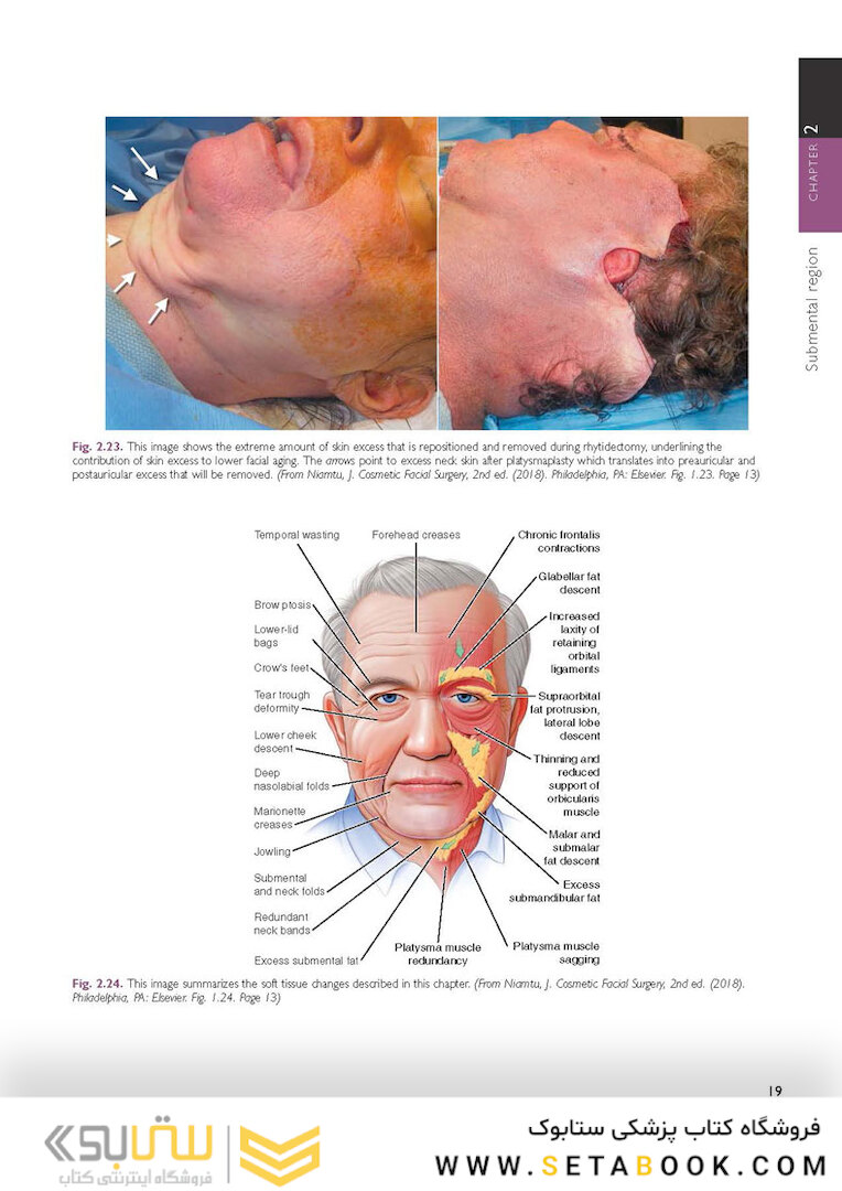 The Art and Science of Facelift Surgery: A Video Atlas 1st Edicion 2019