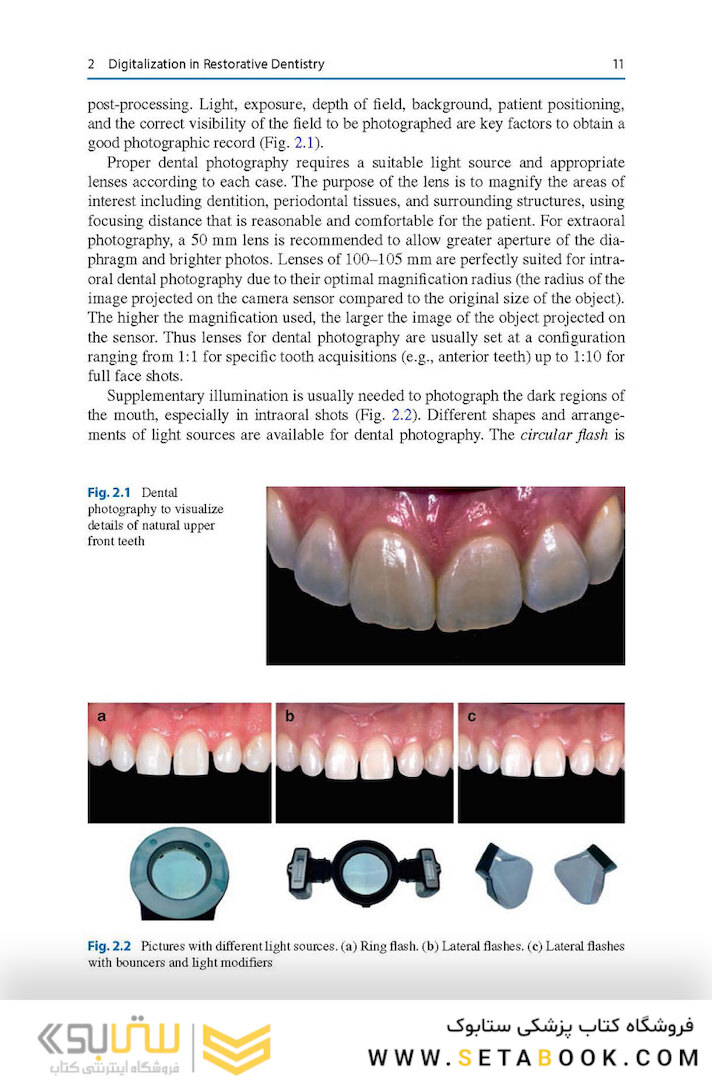 Digital Restorative Dentistry: A Guide to Materials, Equipment, and Clinical Procedures 1st ed. 2019 Edition