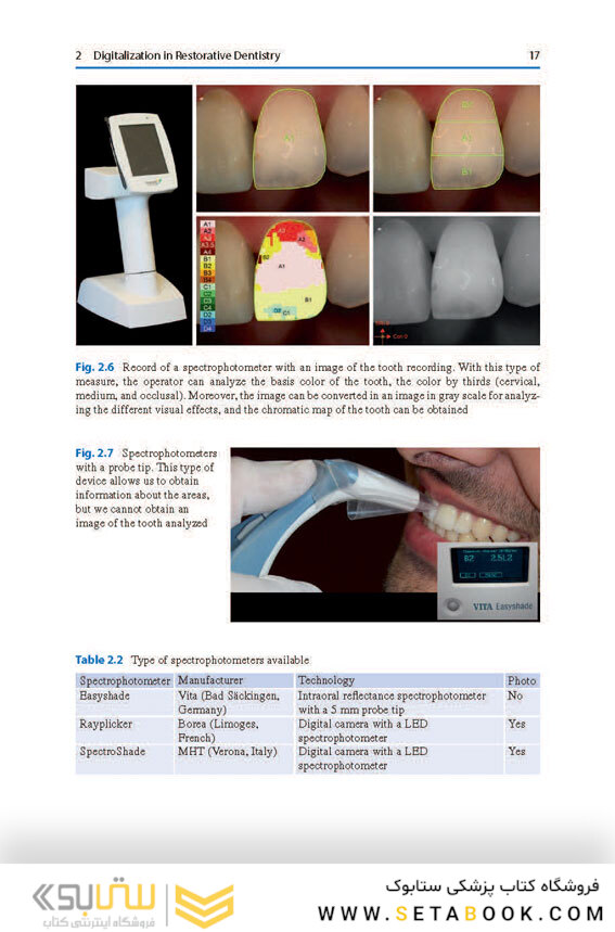Digital Restorative Dentistry: A Guide to Materials, Equipment, and Clinical Procedures 1st ed. 2019 Edition
