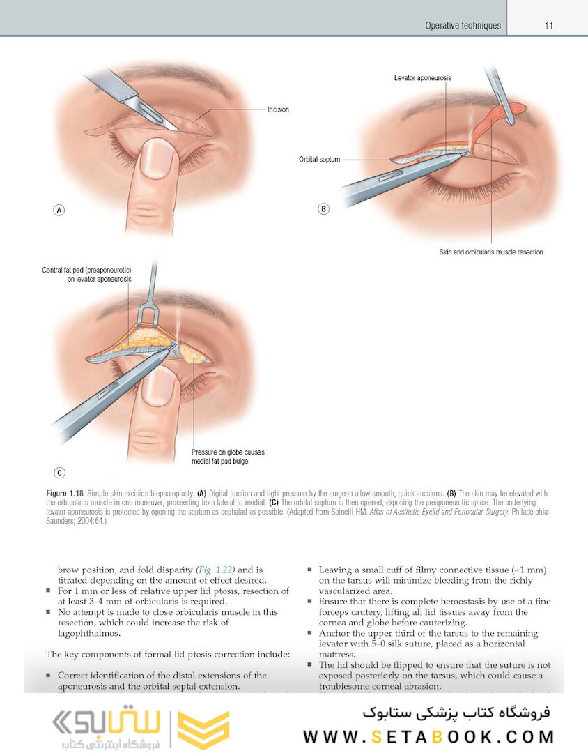 Core Procedures in Plastic Surgery 2nd Edition 2020