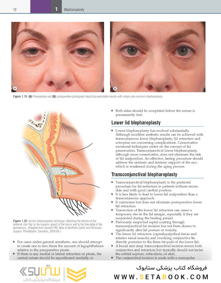Core Procedures in Plastic Surgery 2nd Edition 2020