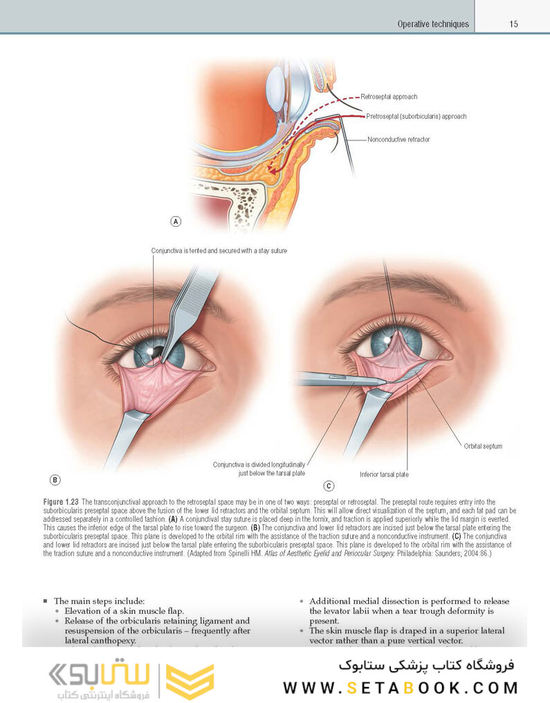 Core Procedures in Plastic Surgery 2nd Edition 2020