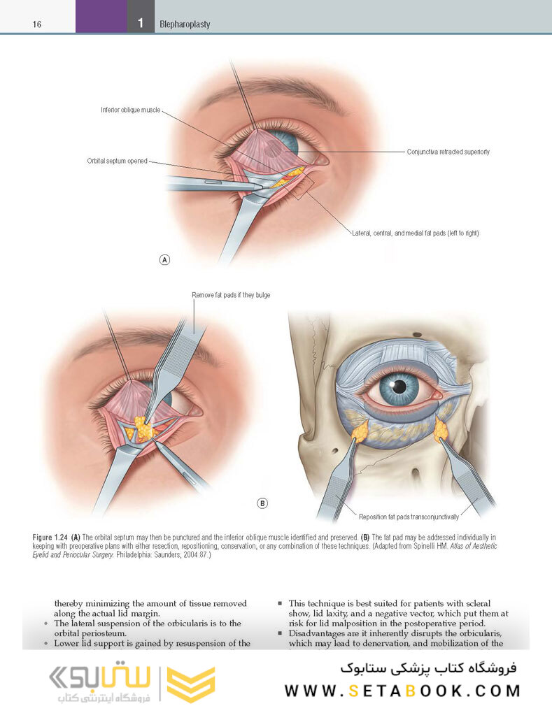 Core Procedures in Plastic Surgery 2nd Edition 2020