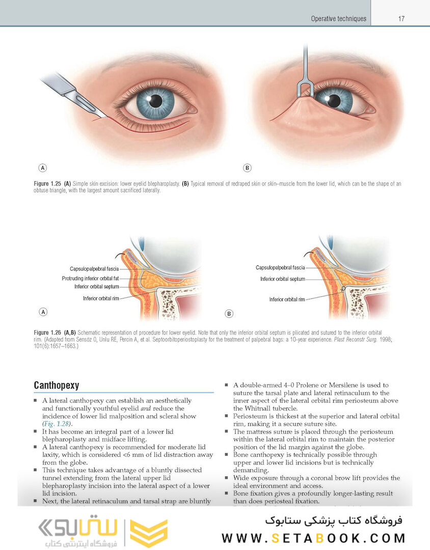 Core Procedures in Plastic Surgery 2nd Edition 2020