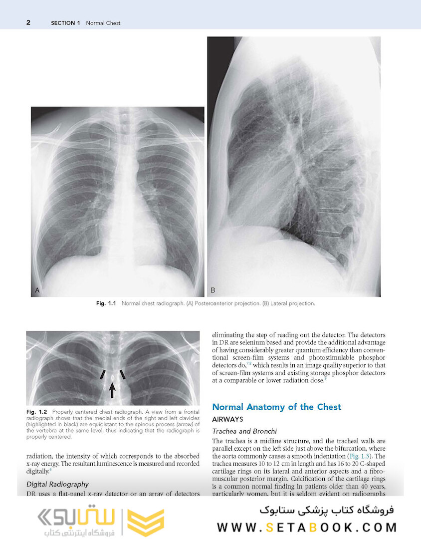 Muller’s Imaging of the Chest, 2nd Edition2018
